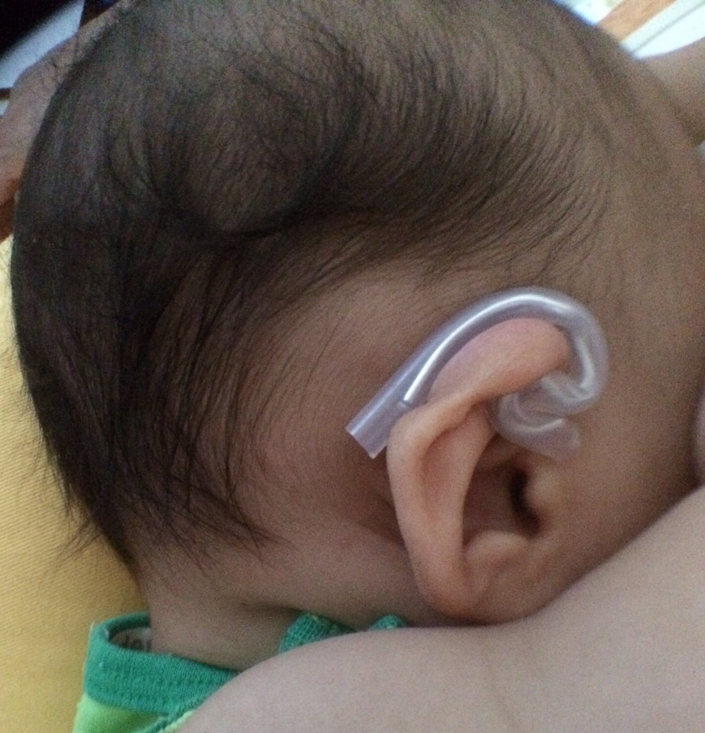 赤ちゃんの耳の変形・埋没耳の矯正器具の作り方 辰子のおうち英語♪バイリンガル育児